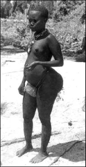 Mujer de la etnia sudafricana Hottentot/Khoisan, con la característica acumulación de grasa en las nalgas.