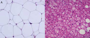 Imagen con microscopio óptico de tejido adiposo blanco (A) y tejido adiposo marrón (B).