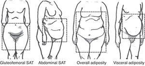 Visual classification of body fat according to its distribution. Adapted from Foster et al.8. SAT, subcutaneous white adipose tissue.