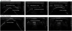 Comparison of images obtained by ultrasonography in the model.