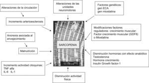 Factores implicados en el desarrollo de la sarcopenia.