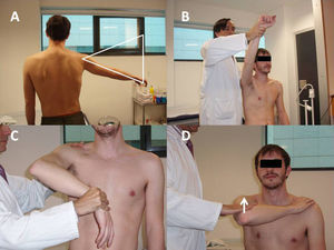 A) Maniobra del arco doloroso. B) Maniobra del impingement de Neer. C) Maniobra de Hawkins-Kennedy. D) Maniobra de Yocum.
