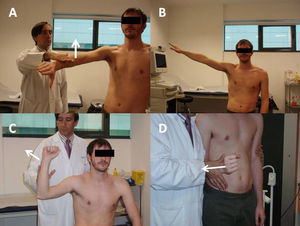 A) Maniobra de Jobe. B) Maniobra del brazo caído. C) Maniobra de Patte. D) Rotación externa contra resistencia.