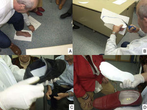 Puntos clave de los programas de prevención: dibujar una plantilla sobre cartulina (A), recortarla (B), introducirla en el zapato (C) y, al extraerla (D), observar la deformidad por presión inadecuada. (Fotografía del Dr. Calle Pascual.)