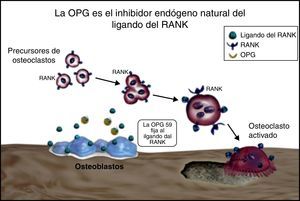 Sistema RANKL/RANK/OPG.