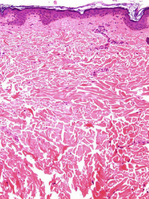 Hematoxylin-eosin stain (original magnification×10).