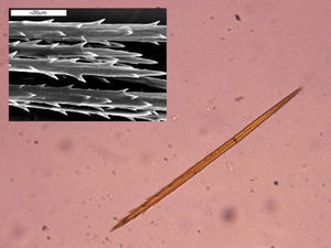 Optical microscope image of an urticating hair (original magnification, x40). Under an electron microscope, it is possible to observe the harpoon form that enables the hairs to lodge in the skin and mucosas.