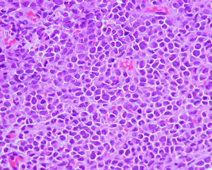 Hematoxylin-eosin, original magnification ×400.