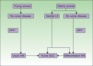 Pathogenic pathways implicated in vulvar squamous cell carcinoma according to Neill et al.8 LS indicates lichen sclerosus; HPV, human papillomavirus; VIN, vulvar intraepithelial neoplasm; SCC, squamous cell carcinoma.