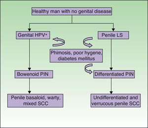Pathogenic pathways implicated in penile squamous cell carcinoma. HPV indicates human papillomavirus; LS, lichen sclerosus; PIN, penile intraepithelial neoplasm.