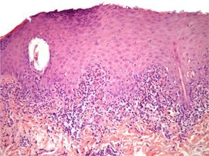 Hematoxylin-eosin, original magnification ×20.