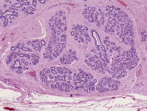 Microscopic image, detail of the acini and ducts of the mammary tissue (hematoxylin–eosin, original magnification ×10).