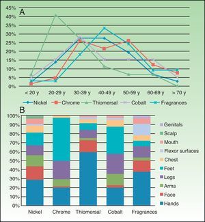 A, Frequency of contact sensitization to the 5 most common allergens in our series by age. B, Site of dermatitis in patients sensitized to the 5 most common allergens.
