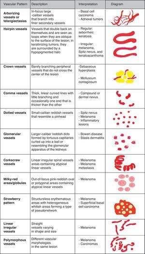 Vessel morphology.
