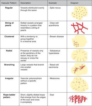 Vessel distribution patterns.