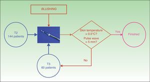 The video-assisted thoracoscopic sympathectomy method used to treat blushing.