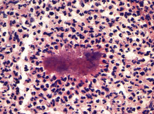 Hematoxylin-eosin, original magnification ×100.
