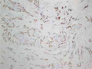 CD31 immunohistochemical staining, original magnification×10.