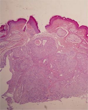 Hematoxylin-eosin, original magnification ×20.