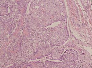 Hematoxylin-eosin, original magnification ×100.
