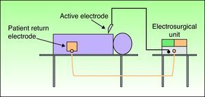 Monopolar circuit consisting of an electrosurgical unit, active electrode, and patient return electrode. The electric current flows through the patient.