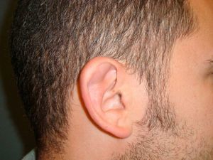 Nodular lesion on the upper edge of the ear which is soft to palpation.