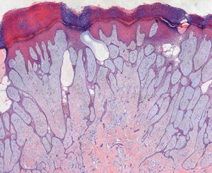 Hematoxylin-eosin, original magnification ×10.