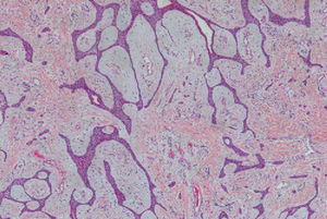Hematoxylin-eosin, original magnification ×40.