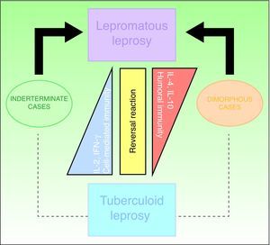 Clinical and immunologic classification system for leprosy. IFN-γ refers to interferón gamma; IL, interleukin.