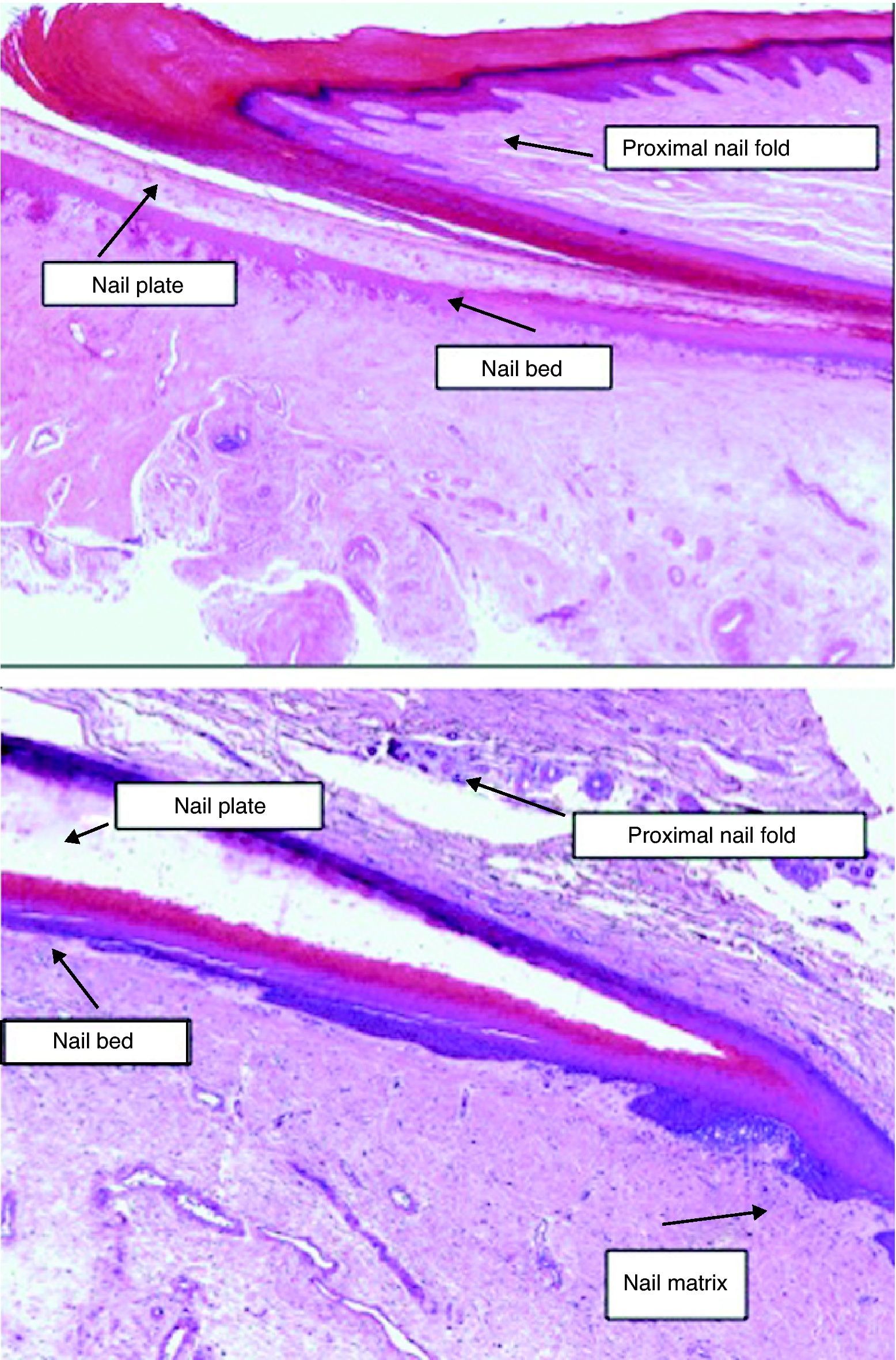Eponychium Histology Nail Histopathology Actas
