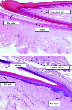 The nail apparatus. Histological appearance of the elements that make up the nail unit (hematoxylin-eosin, original magnification ×20).
