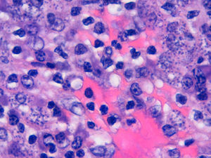 Hematoxylin-eosin, ×400.