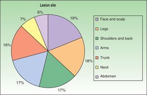 Most frequent sites for skin lesions in patients with disseminated histoplasmosis.
