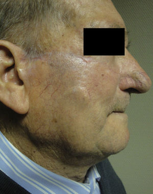 Result 24 months after surgery.