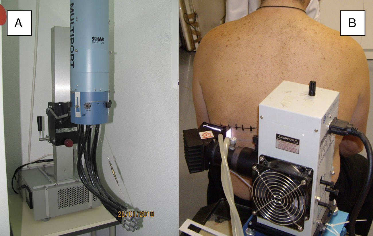Solar Photodermatosis Study of Idiopathic, Exogenous Photodermatoses. Part 1: Pathophysiology ...
