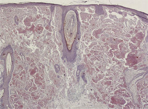 Hematoxylin-eosin staining, original magnification x40.