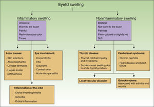 Diagnostic algorithm for palpebral swelling.