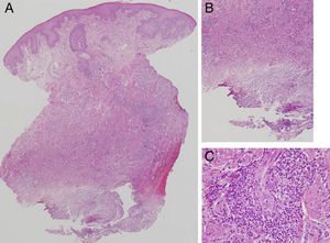 Hematoxylin-eosin. A, original magnification ×20. B, original magnification ×40. C, original magnification ×200.