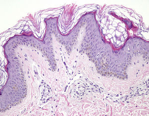 Hematoxylin-eosin, original magnification ×20.