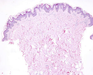 Hematoxylin-eosin, original magnification ×4.