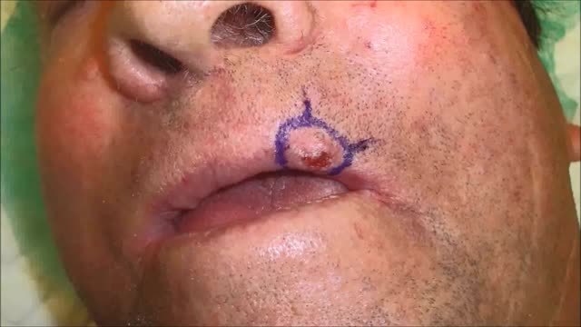 https://ars.els-cdn.com/content/image/1-s2.0-S157821901400273X-mmc1.mp4