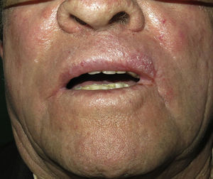 Result 9 months after surgery.
