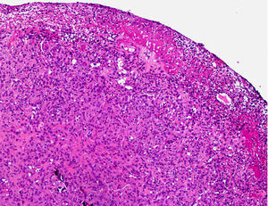 Hematoxylin-eosin, original magnification ×10.