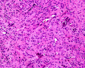 Hematoxylin-eosin, original magnification ×20.