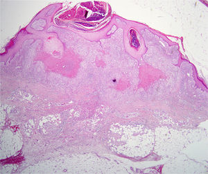 Hematoxylin-eosin, original magnification ×2.