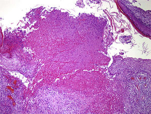 Hematoxylin-eosin, original magnification ×20.
