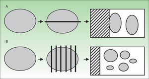 Diagram illustrating how the sentinel node sections were obtained and processed. A, Transhilar bivalving. B, Parallel processing (breadloafing).