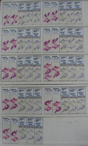 Sections obtained from histologic processing of a single sentinel node.