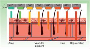 Wavelengths (in nm) used in pulsed light systems according to the target chromophore.