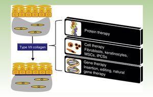 Treatment strategies for recessive dystrophic epidermolysis bullosa. Protein-, cell- and gene-based therapies (boxes on the right) converge on the production of type VII collagen at the dermal-epidermal junction to correct the bullous phenotype (upper left panel) and restore dermal-epidermal adhesion (lower left panel). MSCs indicate mesenchymal stem cells; iPSCs, induced pluripotent stem cells.